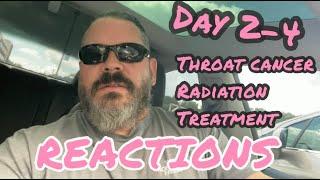 WHAT TO EXPECT | Throat Cancer | Radiation Treatment to cure my cancer | My Reactions Day 2-4