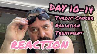 WHAT TO EXPECT | Throat Cancer | Radiation Treatment to cure my cancer | My Reactions Day 10-14