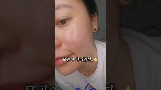 ️여름철 늘어난 모공 삭제하는 홈케어 방법️#모공앰플 #모공 #모공팩 #모공케어 #모공관리 #모공축소