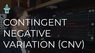 What is Contingent negative variation (CNV)? A series of lectures on evoked potentials