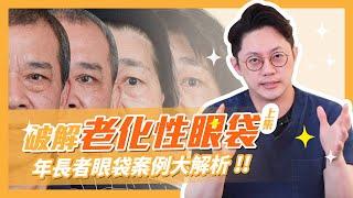 破解老化性眼袋！年長者眼袋案例大解析(上集)｜周杰醫師