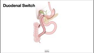 HCC 1475 10p  Surgical Anatomy Duodenal switch