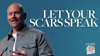 Let Your Scars Speak | Hope After Church Hurt | Twin Rivers Church