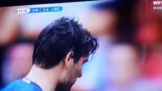 Corluka Bleeding After Injury vs Turkey