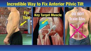 INCREDIBLE Way to Fix Anterior Pelvic Tilt - NEVER BEFORE Seen Exercise!