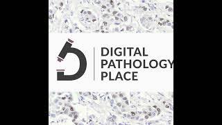 119: DigitPath Digest #19 | Cytology's Digital Revolution, Prostate cancer tsunami + Live AI Demo