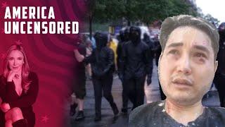 Andy Ngo Reacts To Antifa Attack War Memorial Defacement