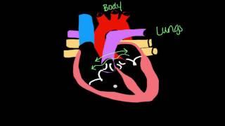 Working your way through Cardiac disorders