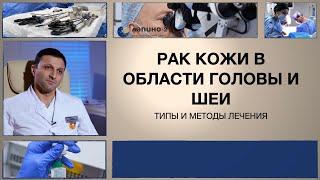 Рак кожи в области головы и шеи: типы и методы лечения.