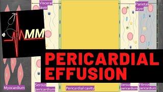 Pericardial Effusion pathogenesis | Understanding Pericardium | Pathology lecture |  Med Madness