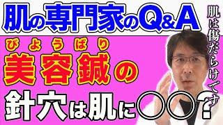 【肌の悩み】美容鍼の傷跡は肌に影響しないのか!?肌の再生医療の専門家による答え【Q&Aライブ切り抜き】