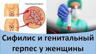 Сифилис и генитальный герпес у женщины