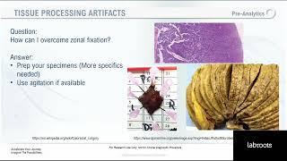 Lessons From The Laboratory: Your Tissue Processing Questions, Answered