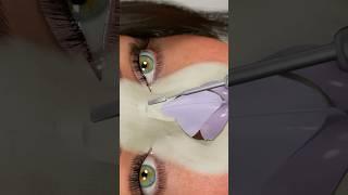 Rhinoplasty in 15 seconds!