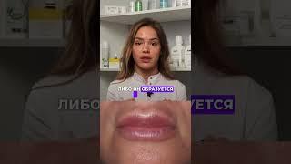 Что такое миграция филлера при увеличении губ #косметология  #врачкосметолог #увеличениегуб