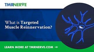 TMR Nerve What Is Targeted Muscle Reinnervation | TMR Nerve