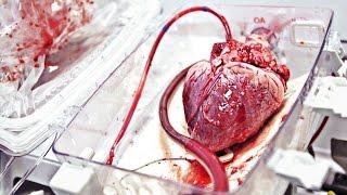 TransMedics Pumping Heart | WIRED