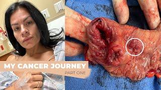 Jessie Lee's Journey Through Stage 4 Colon Cancer (PART 1 - Overcoming The Diagnosis)