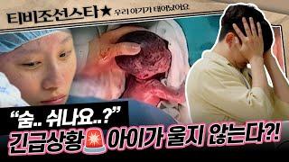 [#우리아기가태어났어요] 드디어 세상 밖으로 나온 세쌍둥이! 그러나 예상치 못한 둘째의 기형이 발견되는데.. #TVCHOSUNSTAR (TV CHOSUN 250516 방송)