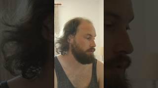 The Hat Slave #balding #baldcafe #hatfish