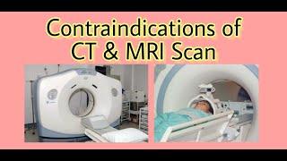 Contraindications of CT & MRI || Radiology Buzz