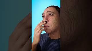 What to Do When You Get a Nosebleed Quick and Easy Tips