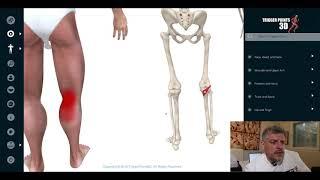 Popliteus - Trigger Point of the Week