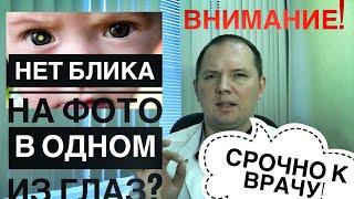 ВНИМАНИЕ! НЕТ БЛИКА В ГЛАЗАХ НА ФОТО - СРОЧНО К ВРАЧУ!