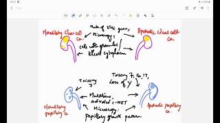 Renal cell carcinoma (RCC) | Pathology | Handwritten notes