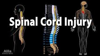 Spinal Cord Injury, Animation