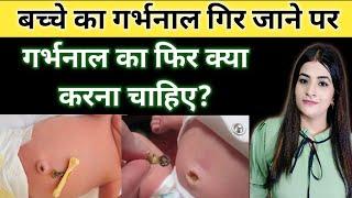 Bachche Ka Garbhnal Gir Jane Par Garbhnal Ka Kya Karna Chahiye | Umblical Cord | Reshu's Baby Care