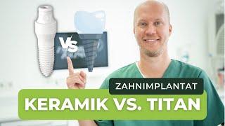 Keramikimplantate vs Titanimplantate: Vorteile von Keramik vs Titan -  mit Christian Zotzmann