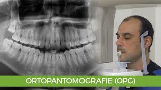 Radiografia (OPG)