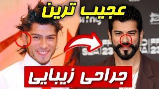 ۱۱ یازده تا از مشهورترین بازیگران مرد ترکیه که عمل زیبایی انجام دادن و نمیدونستید!️