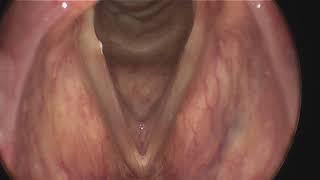 Vocal folds- Pitch Physics Demo