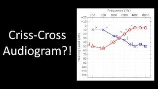 Don't get tricked by this audiogram! Masking tutorial