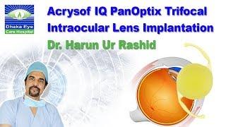 Acrysof IQ PanOptix Trifocal Intraocular Lens Implantation by Dr. Harun Ur Rashid