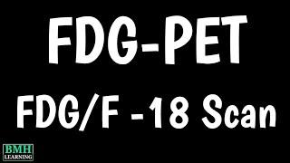 FDG-PET Scan | What Is FDG/F 18 Scan | Fluorodeoxyglucose PET Scan | How PET Scan Drug FDG/F 18 Work