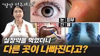 반드시 먹어야 하는 부정맥약 부작용 | 서울아산병원 차명진 교수