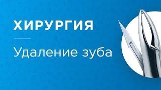 Удаление зуба в Перми. Мнение стоматолога-хирурга Зотовой Оксаны Владимировны. Часть 2.