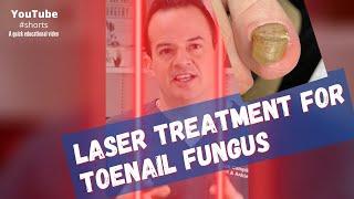 LASER treatment for toenail fungus? #shorts