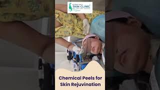 Revitalize Your Glow with Expert Chemical Peels at Public Hospital