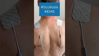 GoodBack Short EMS (Electro Muscular Simulation) #scoliosistherapy #scoliosistreatment #scoliosis