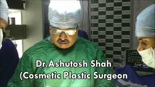 Grade 7 Gynecomastia, Male breast reduction Surgery in Vesu, Surat, Navsari, Vyara, Baroda, Gujarat.