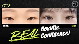 Real Results, Confidence! Part 2 | AB Plastic Surgery Korea