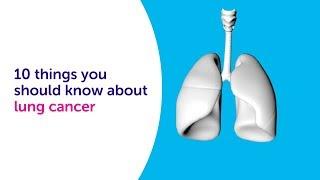 What is Lung Cancer: 10 things you should know about lung cancer | Cancer Research UK