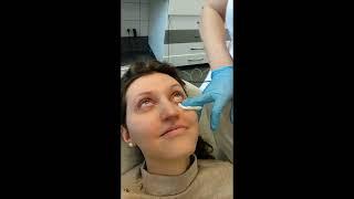 JETT PLASMA LIFT MEDICAL - Dr. Jestřábová performs treatment of Dry Eye