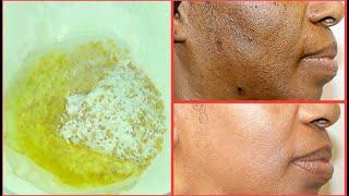 NATURAL EXFOLIATING FACIAL SCRUB FOR CLEARING BLACKHEADS, DARK SPOTS, DULL DRY SKIN, GET CLEAR SKIN