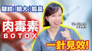 有爱又恨肉毒素；BOTOX Injection | Anti-aging Strategy