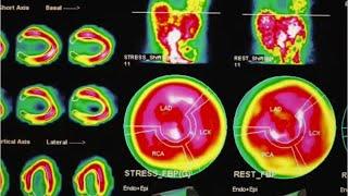 Nuclear Medicine Technologists Career Video